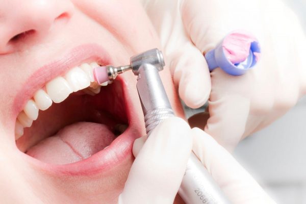 Профессиональная гигиена полости рта – залог здоровья зубов и десен